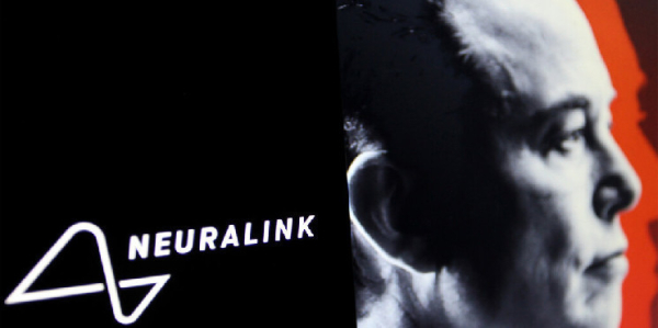 Elon Musk’s Neuralink Opens Its Doors for Brain Implant Human Trials Elon Musk’s Neuralink Opens Its Doors for Brain Implant Human Trials
